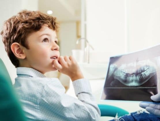 5 Different Types of Preventative Dentistry for Children