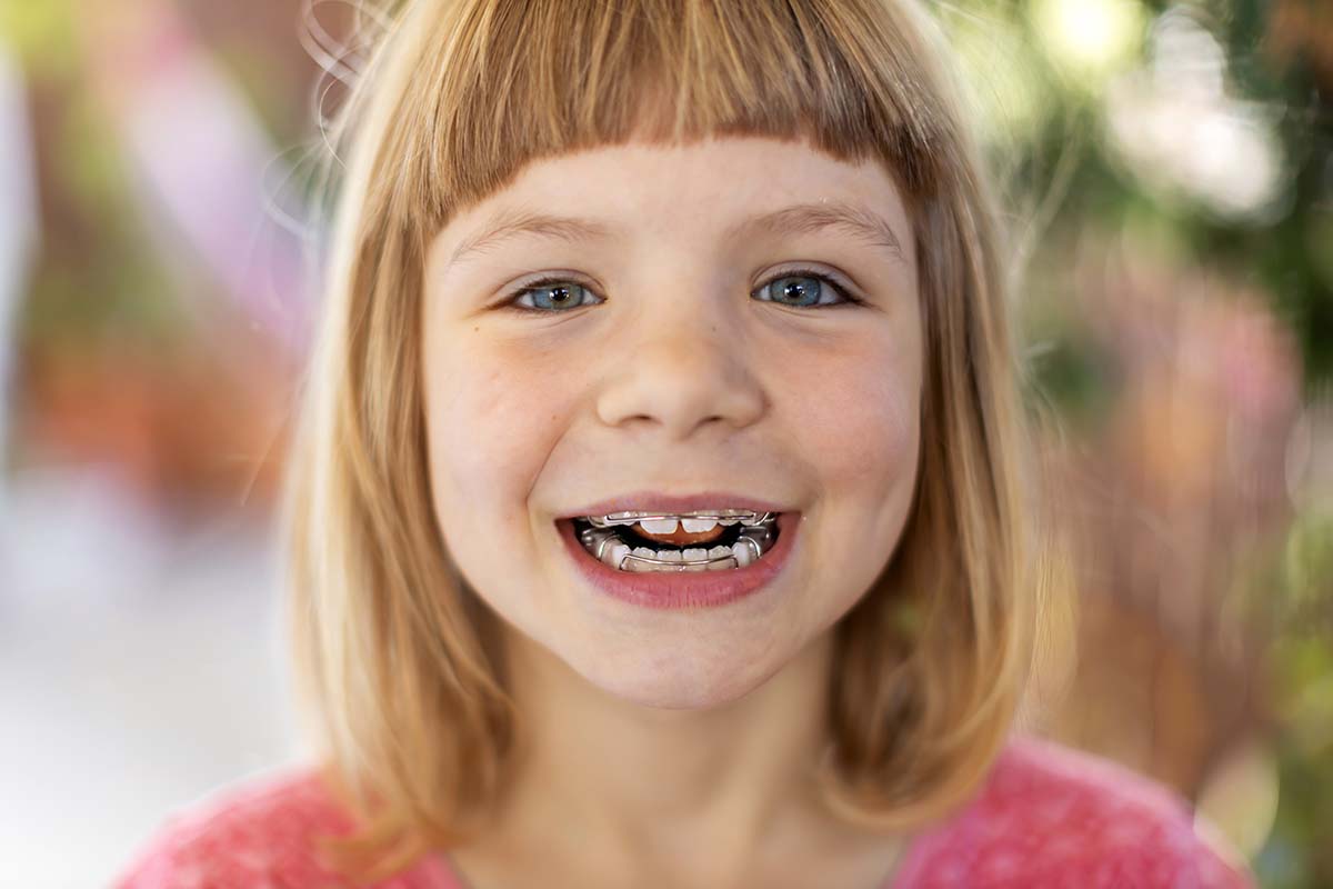 early orthodontics