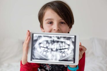 How Often Should Dental X-Rays Be Taken for Children? | Richmond, TX