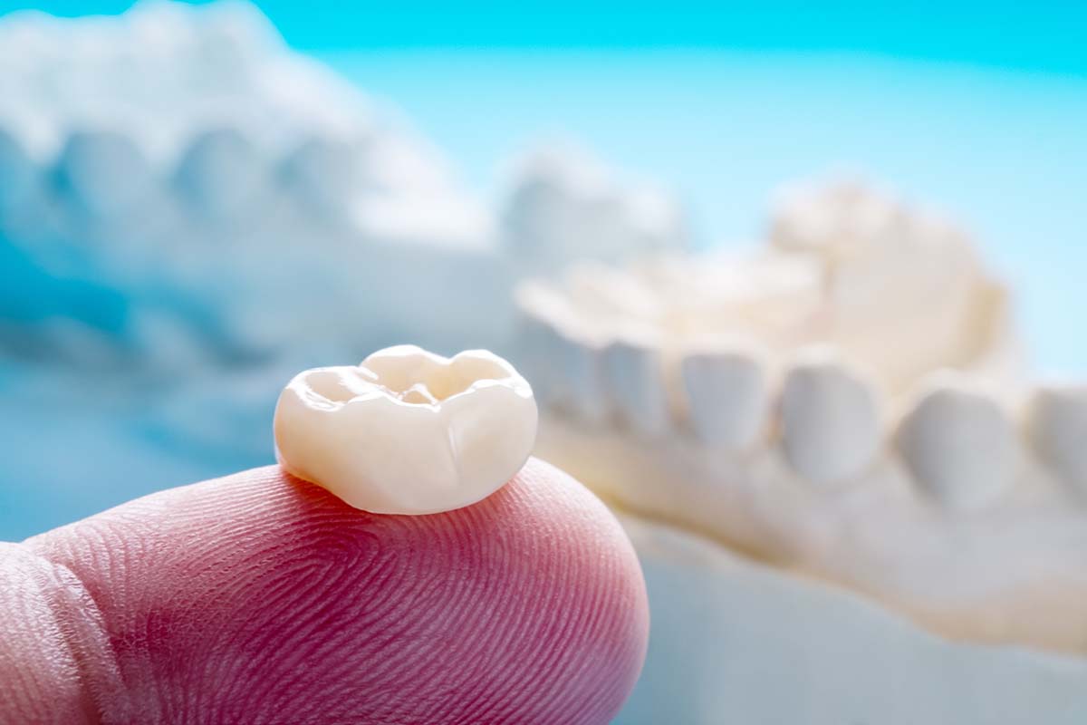 Pediatric Dental Crown