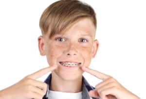 caring for braces