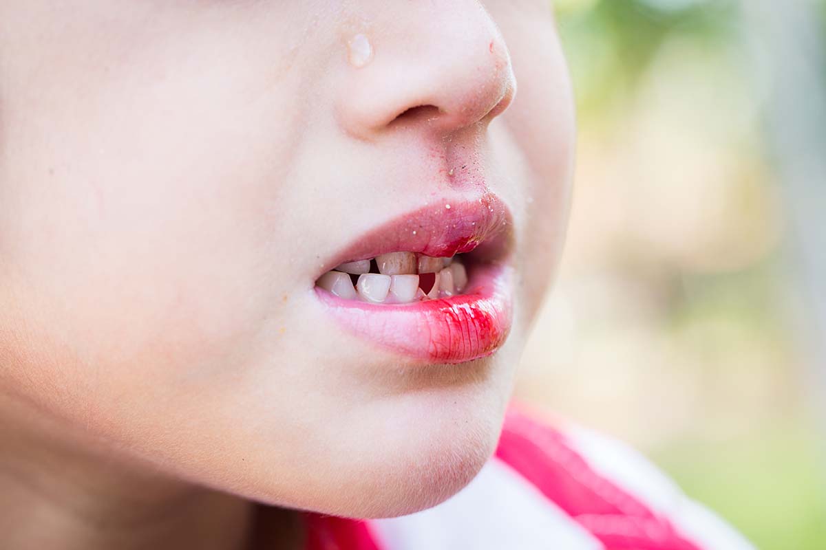 dental emergency in kids