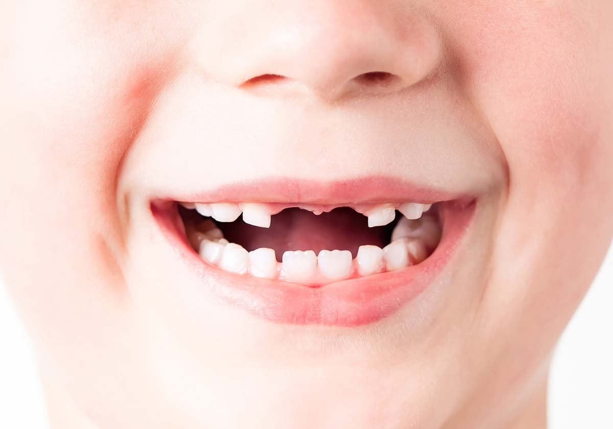 Timeline for Children's Oral Health