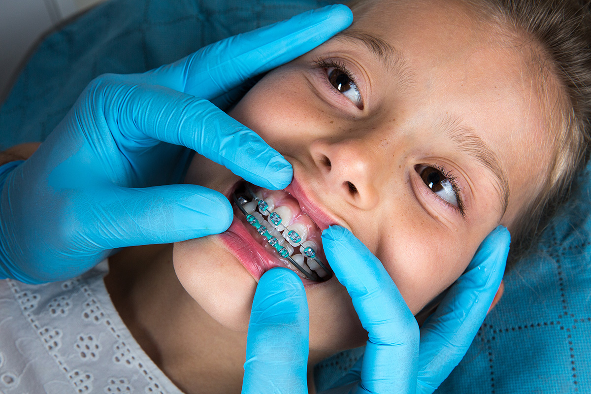 Kids Braces Baby Teeth